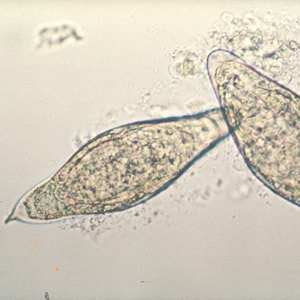 Figure B: Egg of <em>S. intercalatum</em> in a wet mount.