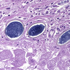 Figure D: Eggs of <em>S. japonicum</em> from tissue, stained with H&E. at 400x magnification.