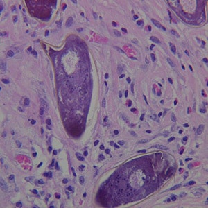 Figure B: Higher magnification of the specimen in Figure A.