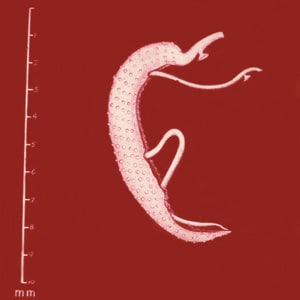 Figure B: Adults of <em>S. mansoni</em>. The thin female resides in the gynecophoral canal of the thicker male. Note the tuberculate exterior of the male.