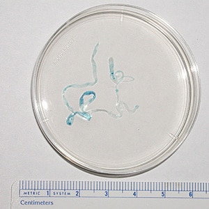 Figure A: Sparganum removed from the chest wall of a patient. The worm measured about 70 mm long. Images from a specimen courtesy of the Oklahoma State Department of Health.