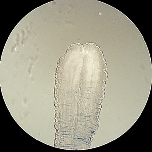 Figure C: Close-up of the anterior end of the sparganum in Figures A and B. Note the end is thickened and wrinkled, and possesses a characteristic cleft-like invagination.