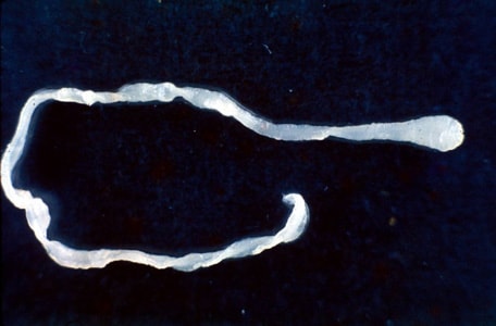 Figure D: Sparganum removed from the ocular conjunctiva of a patient from Taiwan. The worm measured 40 mm long. Image courtesy of Dr. John H. Cross and the Uniformed Services University of the Health Sciences, Bethesda, MD.