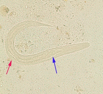 S_stercoralis_rhabditoid_BAM10.jpg Figure E