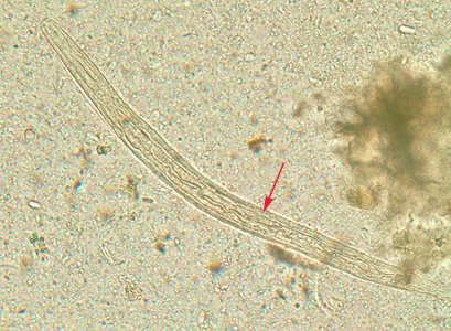 S_stercoralis_rhabditoid_BAM8.jpg Figure A