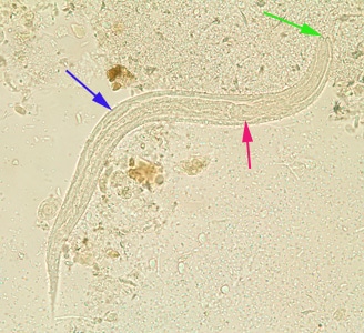 S_stercoralis_rhabditoid_BAM9.jpg Figure F