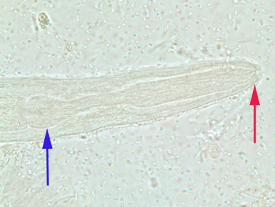 S_stercoralis_rhabditoid_anterior_BAM1.jpg Figure C