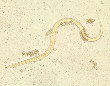 S_stercoralis_filariform_BAM1.jpg Figure A: Filariform (L3) larva of <em>S. stercoralis</em> in an unstained wet mount.