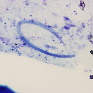 S_stercoralis_filariform_HB1.jpg Figure B