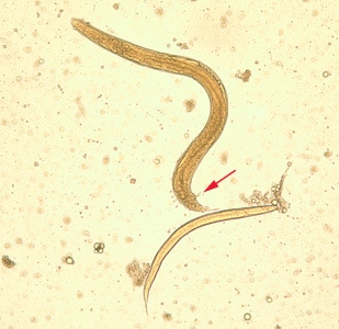 S_stercoralis_adult_larva_BAM1.jpg Figure B: Free living adult male <em>S. stercoralis</em>, showing a spicule (red arrow). A smaller, rhabditiform larva lies adjacent to the adult male.