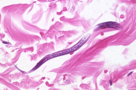 S_stercoralis_intbiopsy_400x_BAM1.jpg Figure F: Longitudinal-section of a larva of <em>S. stercoralis</em> from the same specimen as Figure E. Image taken at 400x magnification.