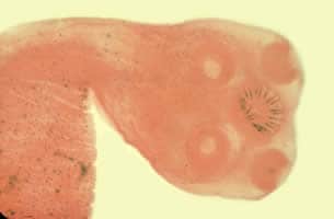 Figure A: Scolex of <em>T. solium</em>. Note the four large suckers and rostellum containing two rows of hooks.