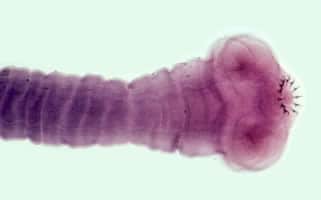 Figure B: Scolex of <em>T. solium</em>. Note the four large suckers and rostellum containing two rows of hooks.