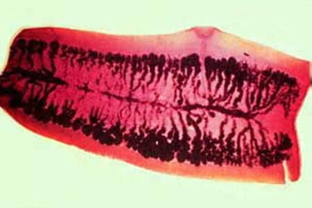 Figure A: Mature proglottid of <em>T. saginata</em>, stained with carmine. Note the number of primary uterine branches (>12).