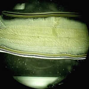 Figure E: Proglottid of <em>T. saginata</em> unstained. Image courtesy of the Oregon State Public Health Laboratory.