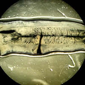 Figure F: The same proglottid as in Figure E injected with India ink, demonstrating the number of primary uterine branches (>12). Image courtesy of the Oregon State Public Health Laboratory.