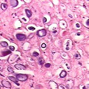 Figure F: Close-up of a cross-section of a <em>Taenia</em> sp. proglottid stained with H&E, showing numerous calcareous corpuscles. Image courtesy of Ameripath.