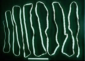 Figure A: <em>Taenia</em> saginata adult worm. The adult in this image is approximately 4 meters in length.