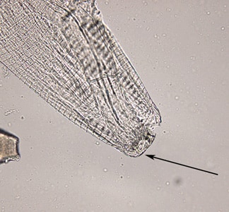 Thelazia_anterior_HB1.jpg Figure A: Anterior end of a female <em>Thelazia californiensis</em> showing small, shallow, buccal cavity (arrow) and prominent widely spaced cuticular striations.