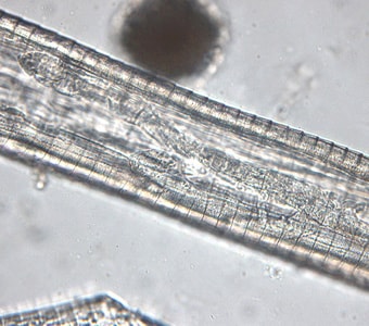 Thelazia_midsection_HB1.jpg Figure B: Mid-section of a female <em>Thelazia californiensis</em>. Note the prominent, widely spaced, and serrate cuticular striations.