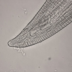 Thelazia_posterior_HB1.jpg Figure C: Posterior end of a female <em>Thelazia californiensis</em> with protruding anal opening and phasmids.