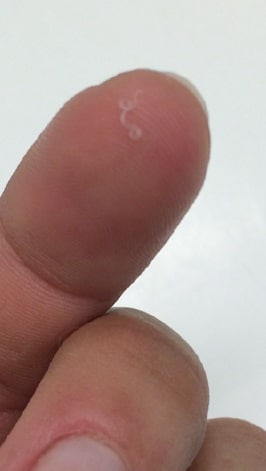 Figure thelaziasis images
