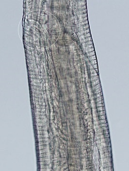 FigureF thelaziasis image
