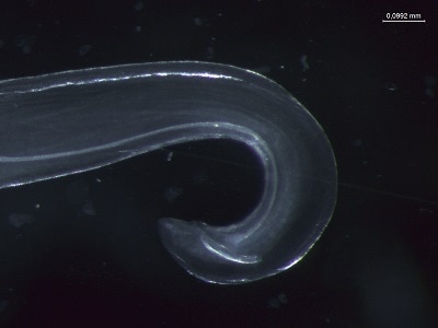 Tcallipaeda_E Figure E: Posterior of adult male Thelazia callipaeda showing spicules (Nomarsky phase contrast).