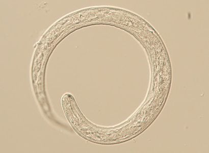 LarvaeA Figure A: L1 larva of Thelazia sp., likely T. callipaeda based on the patient’s travel history. L1 larvae measure up to 400 µm long and 13.5 µm wide. While not visible on this specimen, normally larvae are passed encased in a shell membrane.