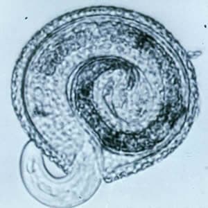 Toxocara_egglarva.jpg Figure A: <em>Toxocara canis</em> larva beginning to hatch.