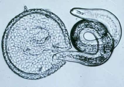 Toxocara_egglarva2.jpg Figure B: <em>T. canis</em> larva hatching.