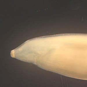 Toxocara_worm2_posterior.jpg Figure F: Close-up of the posterior end of <em>Toxocara</em> sp. Image courtesy of the New Jersey State Public Health Laboratories.