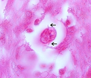 Toxo_cati_alae Figure E