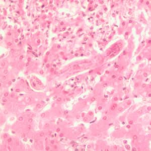 Toxocara_larva2_he.jpg Figure B: Longitudinal section of a <em>Toxocara</em> sp. larva in liver tissue stained with H&E.