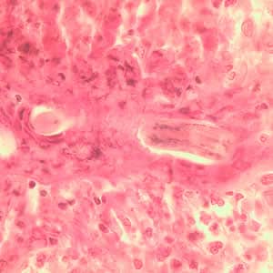 Toxocara_larva3_he.jpg Figure C: Longitudinal section of a <em>Toxocara</em> sp. larva in lung tissue stained with H&E.