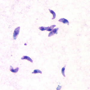 T_gondii_tachy.jpg Figure A: <em>Toxoplasma gondii</em> tachyzoites, stained with Giemsa, from a smear of peritoneal fluid obtained from a laboratory-inoculated mouse.