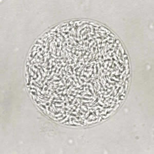 T_gondii_cyst_unstained.jpg Figure A: Unstained cyst of <em>T. gondii</em>.