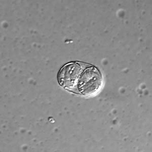 T_gondii_DIC_sporu_100X1.jpg Figure B: <em>Toxoplasma gondii</em> sporulated oocyst in an unstained wet mount, viewed under differential interference contrast (DIC) microscopy.