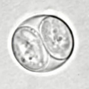 T_gondii_oocyst_sporu.jpg Figure A: <em>Toxoplasma gondii</em> sporulated oocyst in an unstained wet mount.