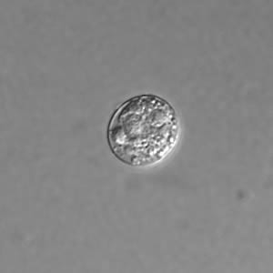 T_gondii_DIC_unsporu_100X1.jpg Figure B: Unsporulated oocyst of <em>T. gondii</em> in an unstained wet mount, viewed with differential interference contrast (DIC) microscopy.