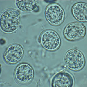T_gondii_ooycst_fecalfloa.jpg Figure C: <em>T. gondii</em> oocysts in a fecal floatation.