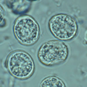 T_gondii_ooycst_fecalfloat2.jpg Figure D: Higher magnification of Figure C.