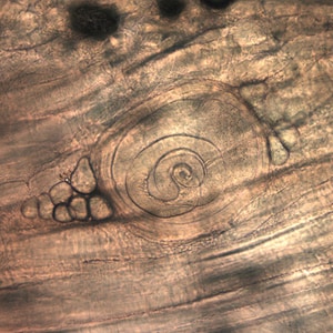 Figure B: <em>Trichinella</em> larva in pressed bear meat, partially digested with pepsin.
