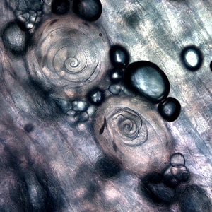 Figure C: <em>Trichinella</em> larvae in pressed bear meat, partially digested with pepsin.