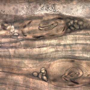 Figure D: <em>Trichinella</em> larvae in pressed bear meat, partially digested with pepsin.