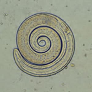 Figure F: Larva of <em>Trichinella</em> liberated from bear meat. This larva is from a different case than those shown in Figures A-D.