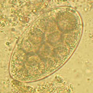Figure A: Egg of a <em>Trichostrongyle</em> in an unstained wet mount of stool from a patient from Afghanistan. Eggs ranged in size from 87-92 µm in length by 50-55 µm in width. Images courtesy of the Leiden University Medical Center, The Netherlands.