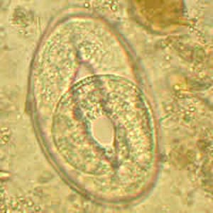 Figure C: Egg of a <em>Trichostrongyle</em> from the same specimen as Figures A and B. In this egg, a developing larva can be observed.