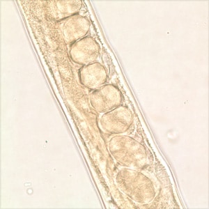 Figure C: Midsection of the same specimen from Figures A and B. Note a row of eggs in the uterus.