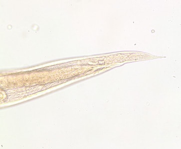 Figure B: Posterior end of the same specimen as Figure A. Note the pointed tail. Image taken at 200x magnification.